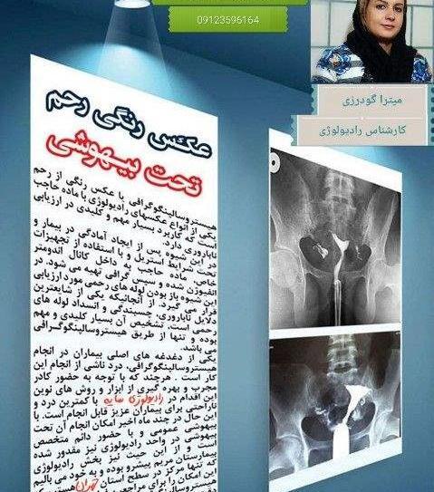 حاملگی بعد عکس رنگی نی نی سایت