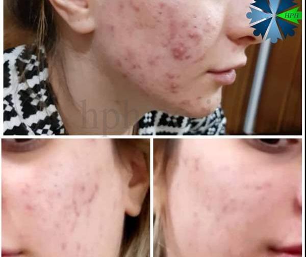 عکس خودم دورگه نی نی سایت