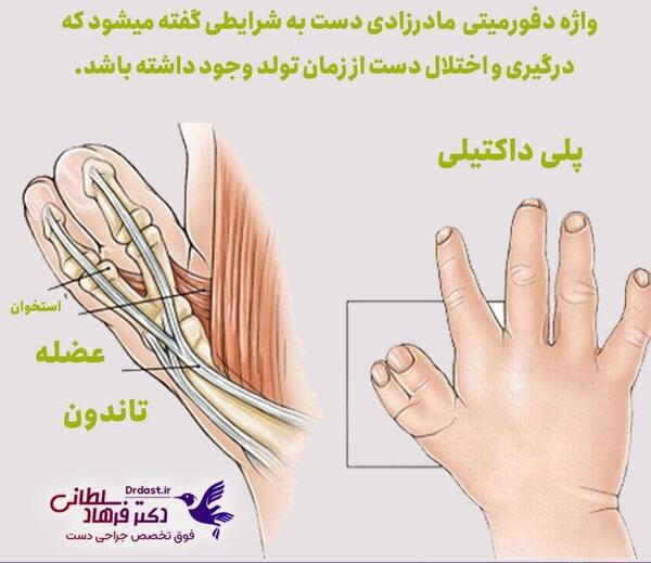 عکس از مچ دست برای رشد قد نی نی سایت