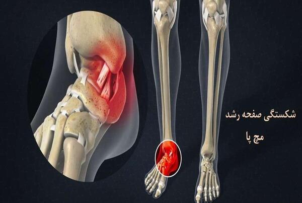 عکس از مچ دست برای رشد قد نی نی سایت