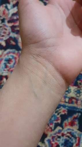 عکس مچ دست نی نی سایت
