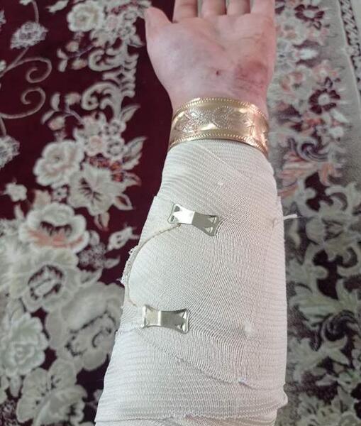 عکس مچ دست نی نی سایت