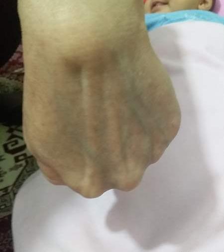 عکس مچ دست نی نی سایت