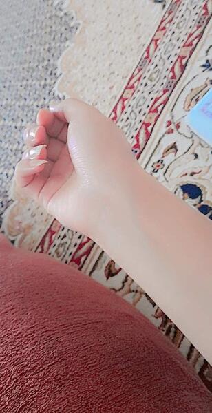 عکس مچ دست نی نی سایت