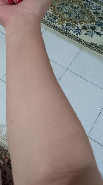 عکس دست شکسته نی نی سایت