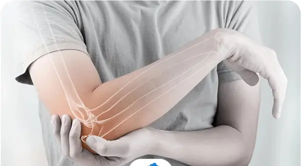 عکس دست شکسته نی نی سایت