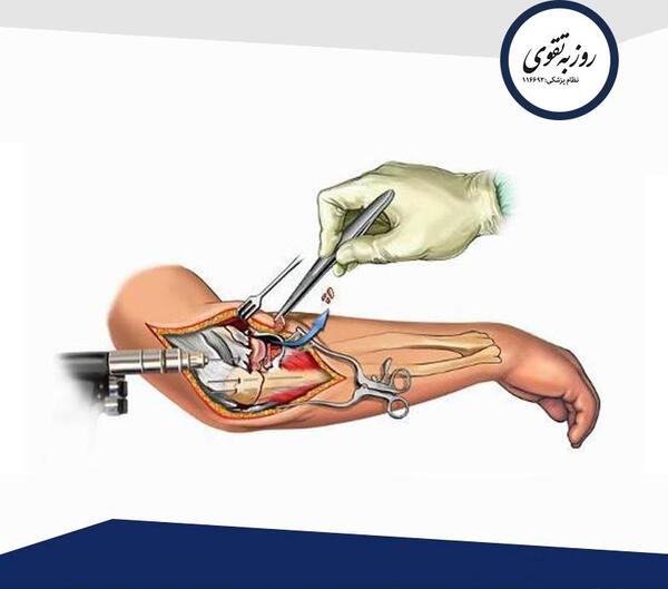 عکس دست شکسته نی نی سایت