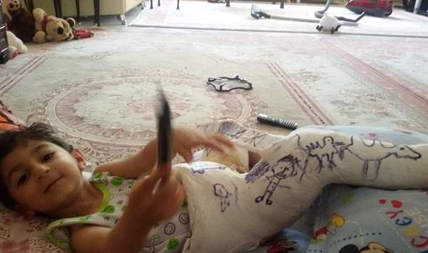 عکس دست شکسته نی نی سایت