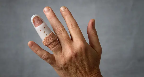 عکس دست شکسته نی نی سایت