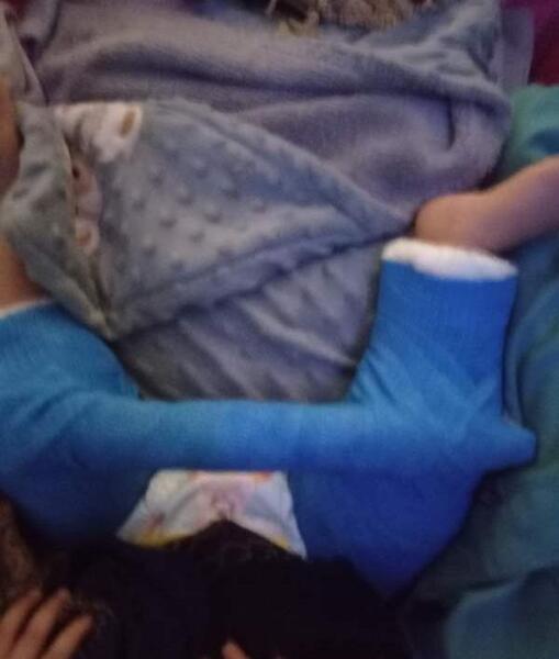 عکس دست شکسته نی نی سایت