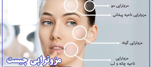 ریکاوری عکس و فیلم نی نی سایت