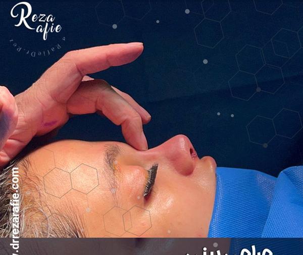ریکاوری عکس و فیلم نی نی سایت