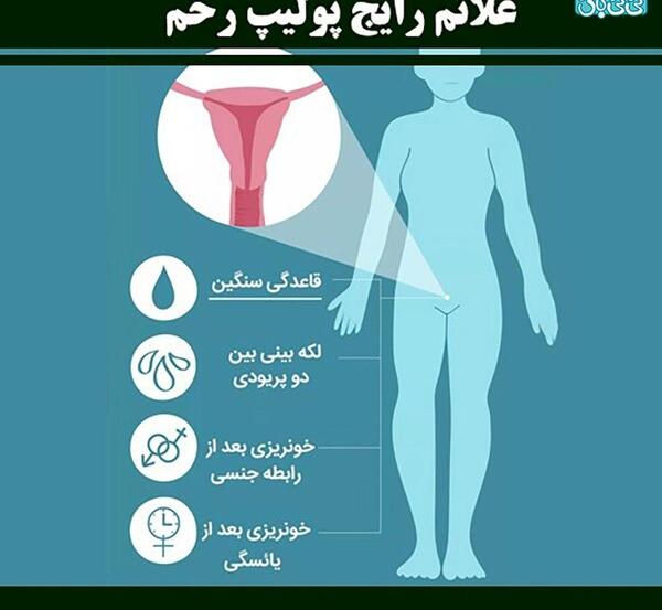 ریکاوری عکس و فیلم نی نی سایت