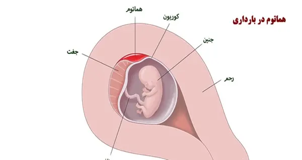 عکس ریه در بارداری نی نی سایت