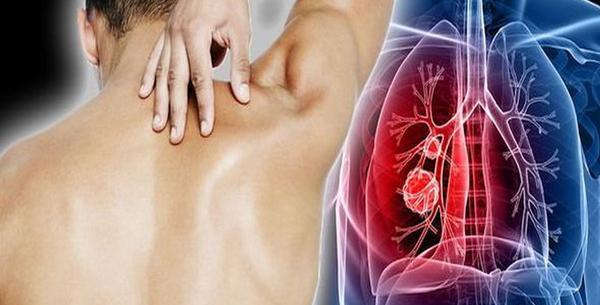 عکس ریه در بارداری نی نی سایت