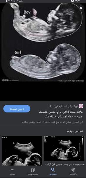عکس رادیولوژی نوزاد نی نی سایت