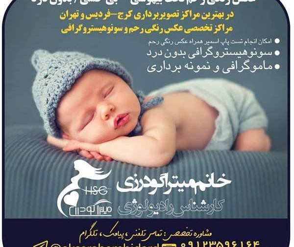 عکس رادیولوژی نوزاد نی نی سایت