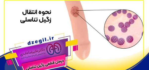 عکس تبخال تناسلی زنان نی نی سایت