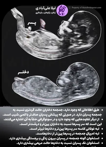 عکس سونو دختر و پسر نی نی سایت
