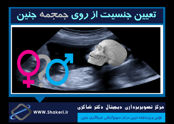عکس سونو جنین دختر ۱۳ هفته نی نی سایت
