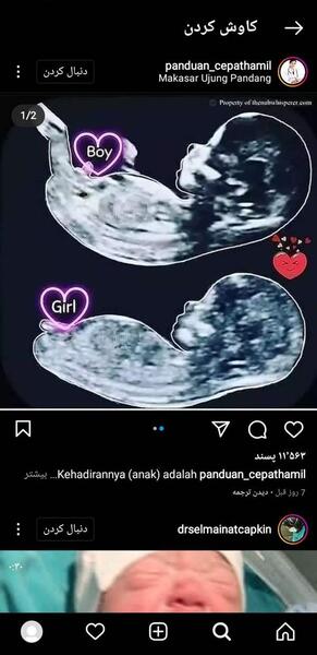 عکس سونو جنین دختر ۱۳ هفته نی نی سایت