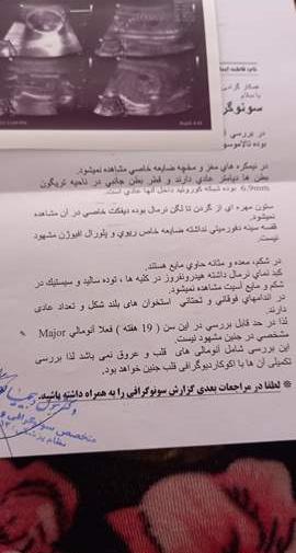 عکس سونوگرافی آنومالی نی نی سایت