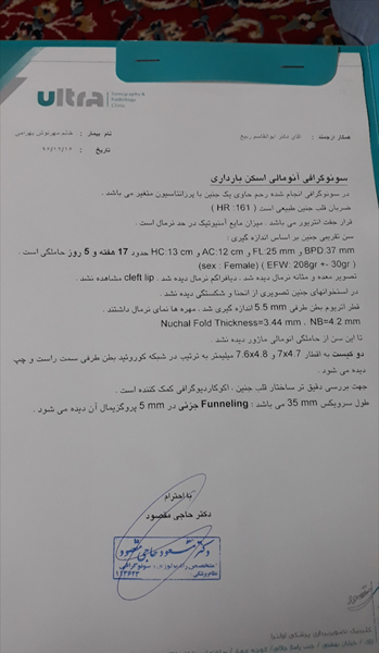 عکس سونوگرافی آنومالی نی نی سایت