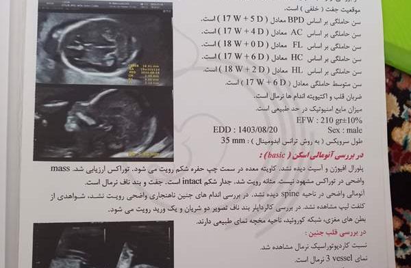 عکس سونوگرافی آنومالی نی نی سایت