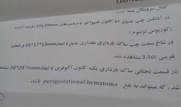 عکس سونوگرافی هفته هشتم بارداری نی نی سایت