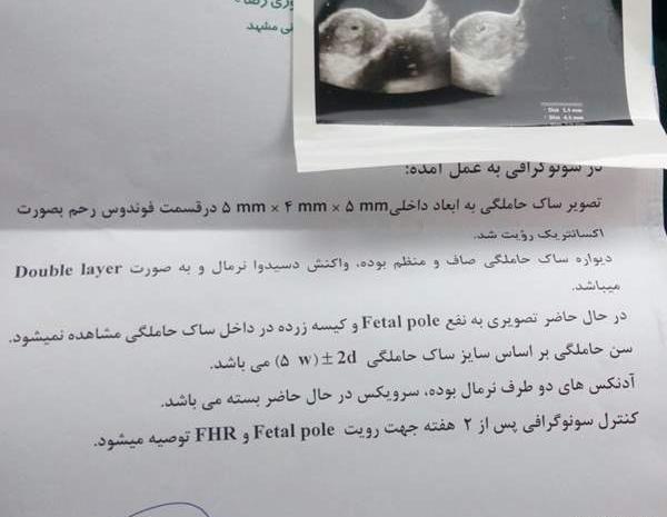 عکس سونوگرافی هفته هشتم بارداری نی نی سایت
