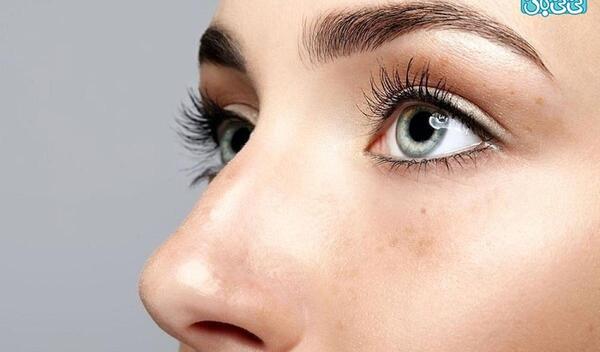 عکس عمل بینی گوشتی و پهن نی نی سایت
