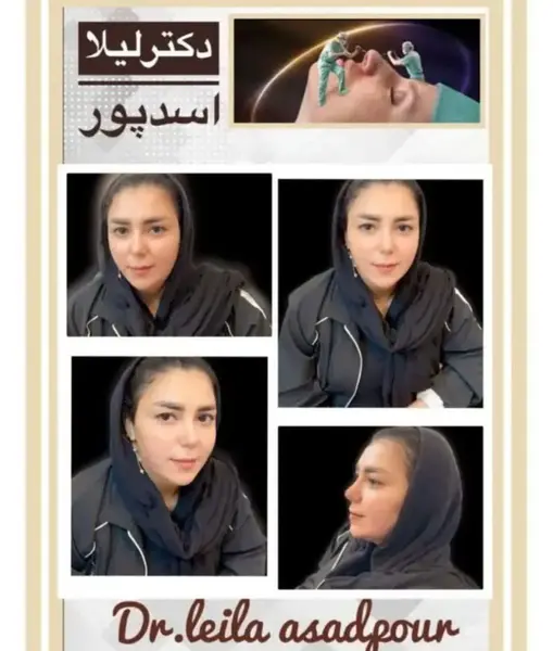 عکس عمل بینی گوشتی و پهن نی نی سایت