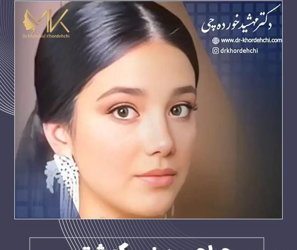عکس عمل بینی گوشتی و پهن نی نی سایت