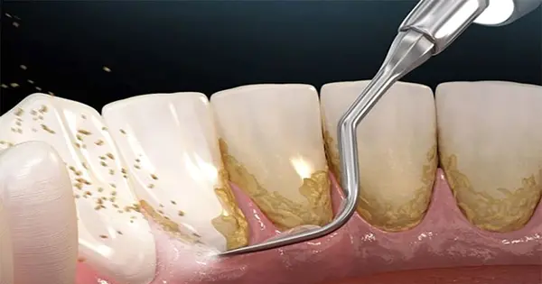 عکس گرفتن دندان نی نی سایت