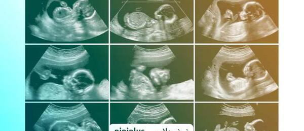 اسکن عکس با گوشی نی نی سایت