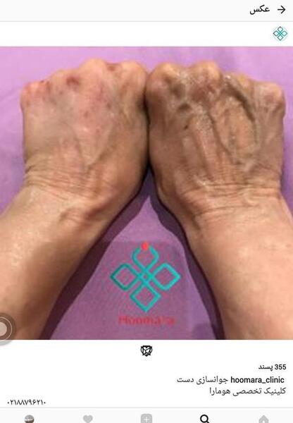 اسکن عکس با گوشی نی نی سایت