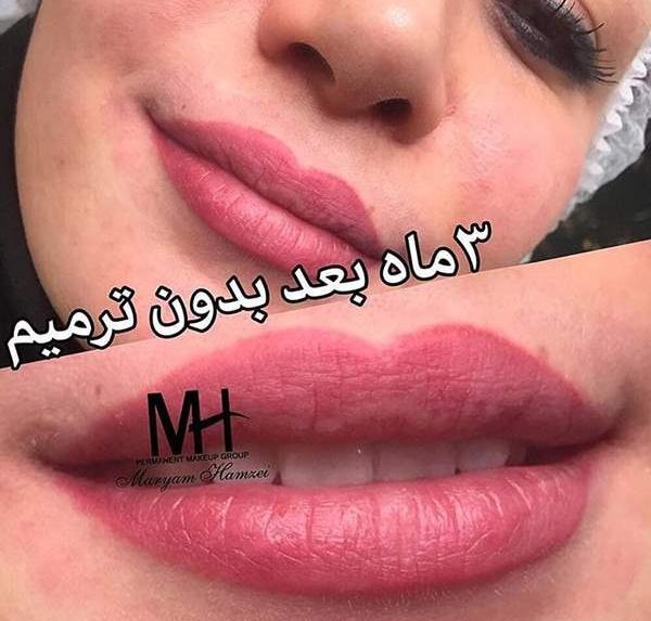 عکس قبل و بعد شیدینگ لب نی نی سایت