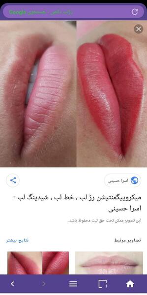 عکس قبل و بعد شیدینگ لب نی نی سایت
