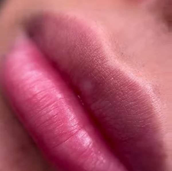 عکس قبل و بعد شیدینگ لب نی نی سایت