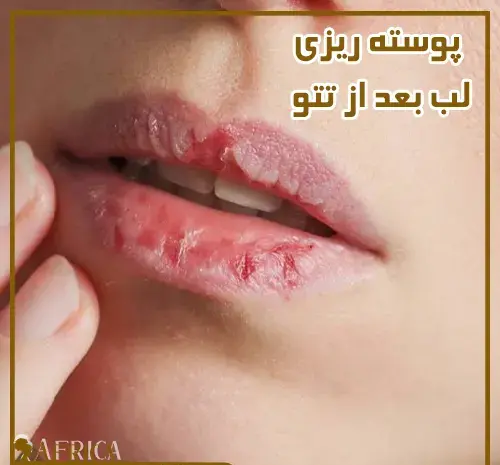 عکس قبل و بعد شیدینگ لب نی نی سایت