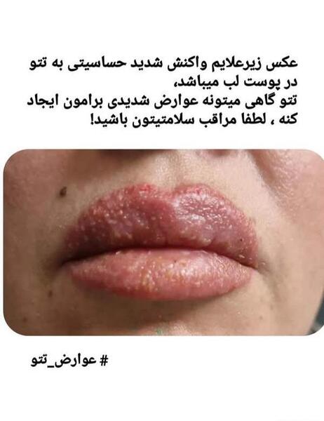عکس شیدینگ لب نی نی سایت