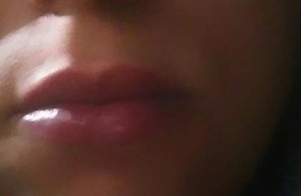عکس پروتز لب نی نی سایت