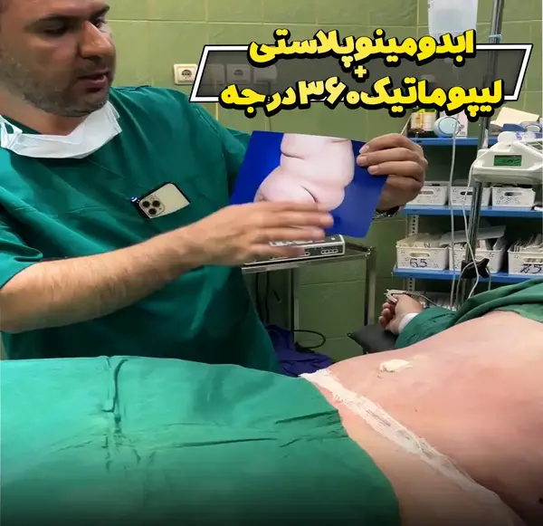 عکس های عمل لابیاپلاستی نی نی سایت