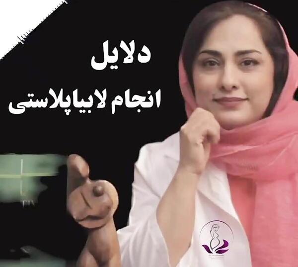 عکس های عمل لابیاپلاستی نی نی سایت