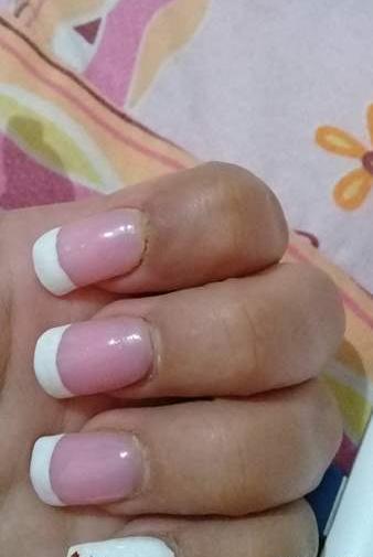 عکس قارچ ناخن نی نی سایت