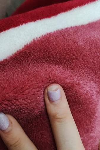 عکس قارچ ناخن نی نی سایت