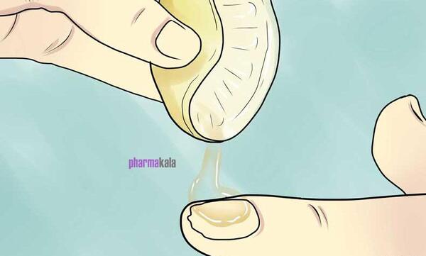 عکس قارچ ناخن نی نی سایت