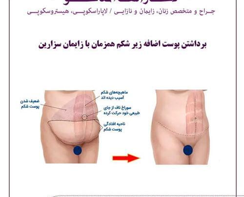 عکس واژن بعد از زایمان طبیعی نی نی سایت