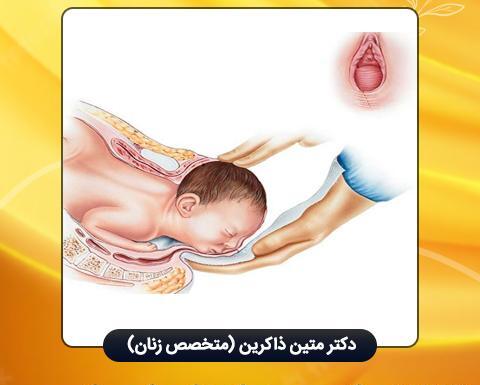 عکس واژن بعد از زایمان طبیعی نی نی سایت
