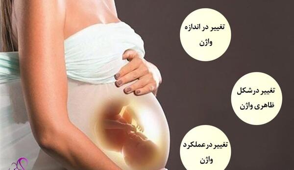 عکس واژن بعد از زایمان طبیعی نی نی سایت